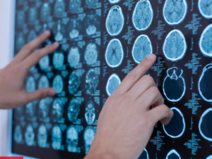 Pratiquer ce sport à haut niveau est dangereux pour le cerveau, mais c’est probablement pire que ce que nous pensions